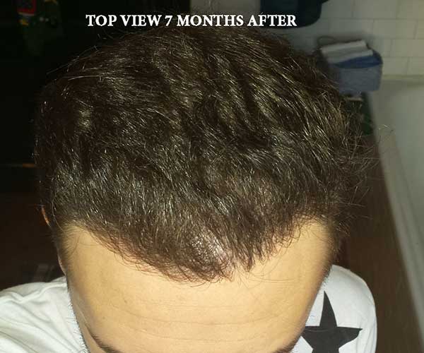 7-months-after-_-top-view